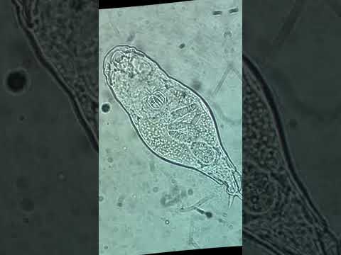 Baffling Wonders: The Secret Lives of Bdelloid Rotifers Unveiled!