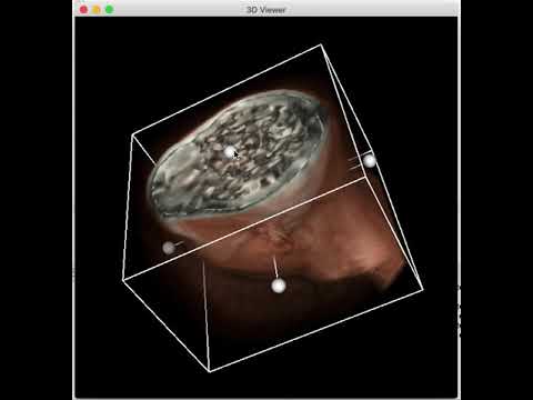 VR -Volume Rendering-