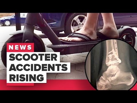 Electric scooter injuries on the rise (CNET News)