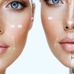 How AI is Reshaping the Cosmetic Surgery Industry