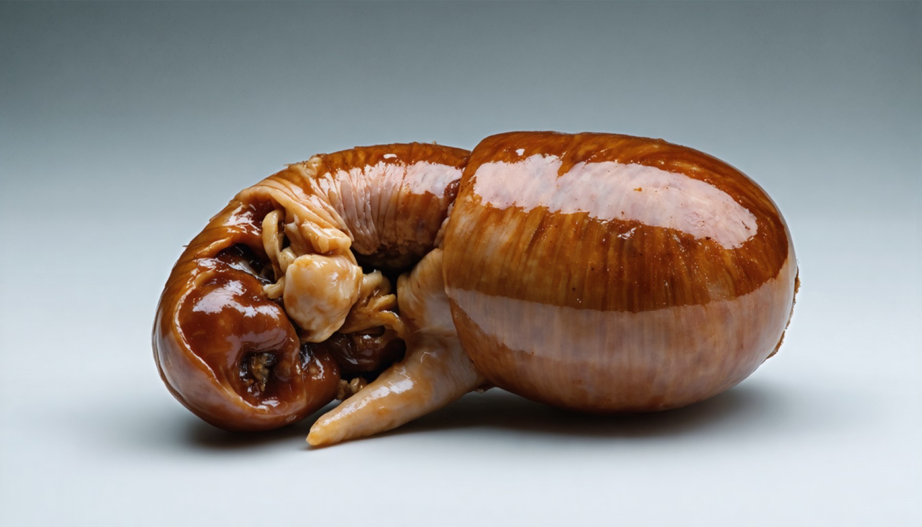 Pig Kidney Xenografts: The $10B Medical Breakthrough Set to Disrupt Transplants by 2028 (2025) 