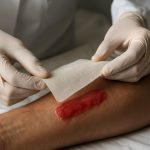 Nanocellulose Wound Care Technologies Market 2025: Rapid Growth Driven by Biocompatibility & Sustainability Trends